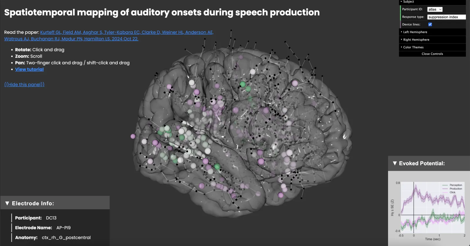 Onset responses in insula